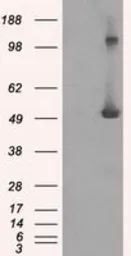 Anti-IFIT3 antibody [1G1] used in Western Blot (WB). GTX84314