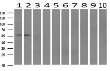 Anti-IFIT1 antibody [3G8] used in Western Blot (WB). GTX84315