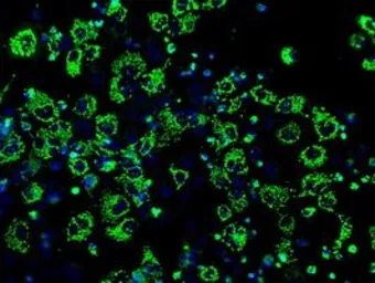 Anti-IDH3A antibody [2F11] used in Immunocytochemistry/ Immunofluorescence (ICC/IF). GTX84317