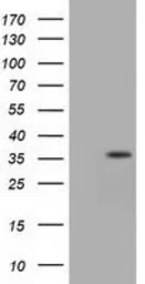 Anti-IDH3A antibody [5D2] used in Western Blot (WB). GTX84318