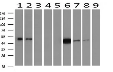 Anti-IDH1 antibody [2H9] used in Western Blot (WB). GTX84319