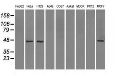 Anti-IDH1 antibody [2H9] used in Western Blot (WB). GTX84319