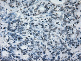 Anti-ID3 antibody [15F4] used in IHC (Paraffin sections) (IHC-P). GTX84320