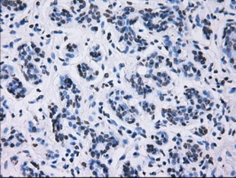 Anti-ID3 antibody [15F4] used in IHC (Paraffin sections) (IHC-P). GTX84320