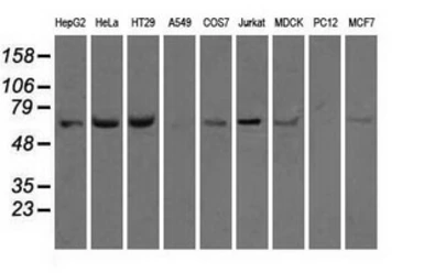 Anti-Hsp70 antibody [2C12] used in Western Blot (WB). GTX84341