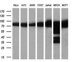Anti-Hsp90 alpha antibody [3B5] used in Western Blot (WB). GTX84343