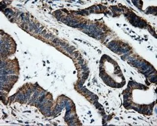 Anti-ERAB antibody [10B4] used in IHC (Paraffin sections) (IHC-P). GTX84346