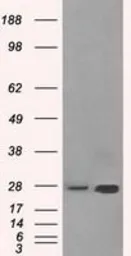 Anti-ERAB antibody [10B4] used in Western Blot (WB). GTX84346