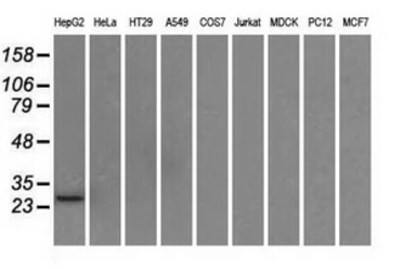 Anti-ERAB antibody [10B4] used in Western Blot (WB). GTX84346