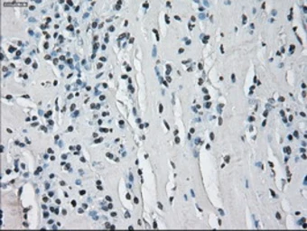 Anti-ERAB antibody [11A2] used in IHC (Paraffin sections) (IHC-P). GTX84347