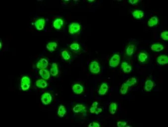 Anti-hnRNP F antibody [5F5] used in Immunocytochemistry/ Immunofluorescence (ICC/IF). GTX84356