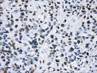 Anti-hnRNP F antibody [5F5] used in IHC (Paraffin sections) (IHC-P). GTX84356
