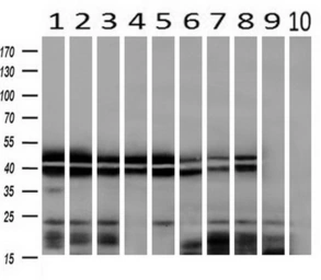 Anti-hnRNP F antibody [5F5] used in Western Blot (WB). GTX84356