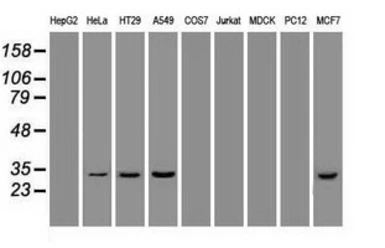 Anti-Hex antibody [3C4] used in Western Blot (WB). GTX84372