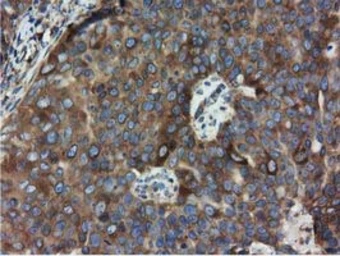 Anti-HDAC6 antibody [4C5] used in IHC (Paraffin sections) (IHC-P). GTX84377