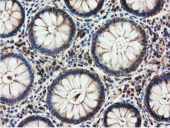 Anti-HDAC6 antibody [4C5] used in IHC (Paraffin sections) (IHC-P). GTX84377