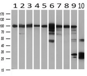 Anti-H6PD antibody [2A7] used in Western Blot (WB). GTX84395
