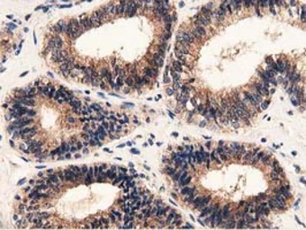 Anti-GSTT2 antibody [2E3] used in IHC (Paraffin sections) (IHC-P). GTX84400