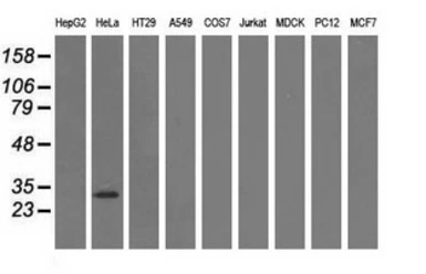Anti-GSTT2 antibody [2E3] used in Western Blot (WB). GTX84400