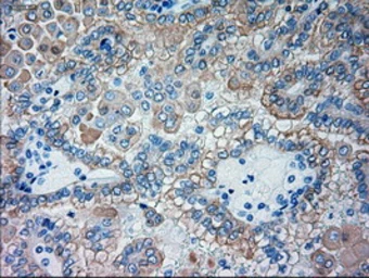 Anti-GSC antibody [1D7] used in IHC (Paraffin sections) (IHC-P). GTX84408