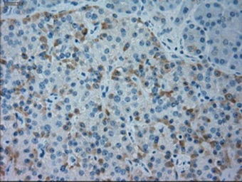 Anti-GSC antibody [1D7] used in IHC (Paraffin sections) (IHC-P). GTX84408