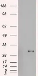 Anti-GSC antibody [1D7] used in Western Blot (WB). GTX84408