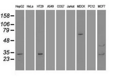 Anti-GSC antibody [1D7] used in Western Blot (WB). GTX84408