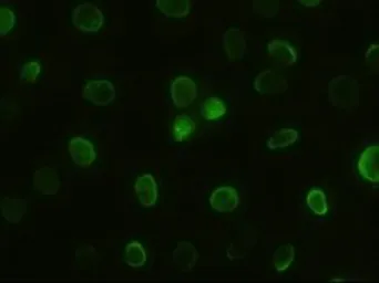 Anti-GSC antibody [4F11] used in Immunocytochemistry/ Immunofluorescence (ICC/IF). GTX84409