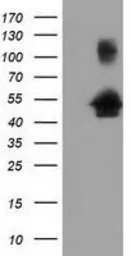 Anti-GRASP65 antibody [4F8] used in Western Blot (WB). GTX84422