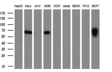 Anti-GBP2 antibody [4E7] used in Western Blot (WB). GTX84442