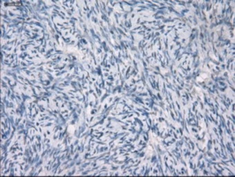 Anti-GBP2 antibody [1E5] used in IHC (Paraffin sections) (IHC-P). GTX84445