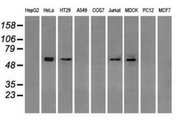Anti-GBP2 antibody [1E5] used in Western Blot (WB). GTX84445