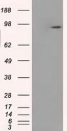Anti-GBE1 antibody [1D11] used in Western Blot (WB). GTX84452