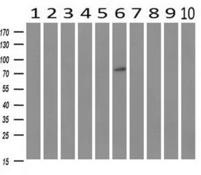 Anti-GBE1 antibody [1D11] used in Western Blot (WB). GTX84452