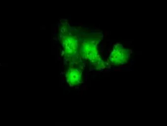 Anti-GBE1 antibody [4D9] used in Immunocytochemistry/ Immunofluorescence (ICC/IF). GTX84453