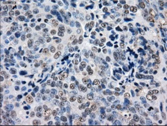 Anti-GBE1 antibody [3C8] used in IHC (Paraffin sections) (IHC-P). GTX84454