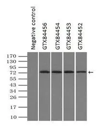 Anti-GBE1 antibody [3C8] used in Immunoprecipitation (IP). GTX84454