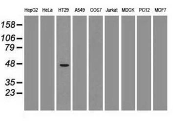 Anti-GATA4 antibody [9F9] used in Western Blot (WB). GTX84460