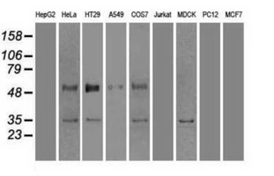 Anti-GAD67 antibody [3G9] used in Western Blot (WB). GTX84469