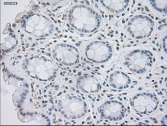 Anti-GAD67 antibody [3H2] used in IHC (Paraffin sections) (IHC-P). GTX84470