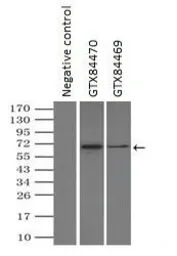 Anti-GAD67 antibody [3H2] used in Immunoprecipitation (IP). GTX84470