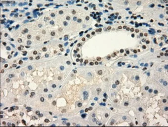 Anti-FRK antibody [6D2] used in IHC (Paraffin sections) (IHC-P). GTX84481