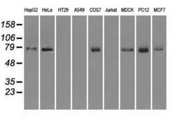 Anti-Mig-2 antibody [14A11] used in Western Blot (WB). GTX84506