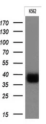 Anti-CD32a antibody [16D6] used in Western Blot (WB). GTX84509