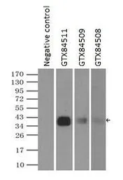 Anti-CD32a antibody [13D7] used in Immunoprecipitation (IP). GTX84511