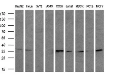 Anti-CD32a antibody [13D7] used in Western Blot (WB). GTX84511