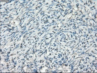 Anti-CD32a antibody [13G9] used in IHC (Paraffin sections) (IHC-P). GTX84513