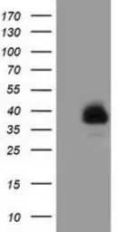 Anti-FAM84B antibody [2E7] used in Western Blot (WB). GTX84524