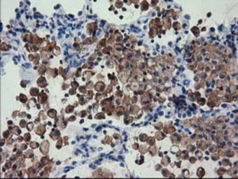 Anti-FAM84B antibody [4A4] used in IHC (Paraffin sections) (IHC-P). GTX84525
