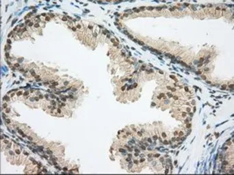 Anti-ERCC1 antibody [1B3] used in IHC (Paraffin sections) (IHC-P). GTX84546